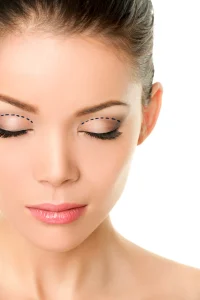 Augenlidstraffung in Antalya – Blepharoplastik