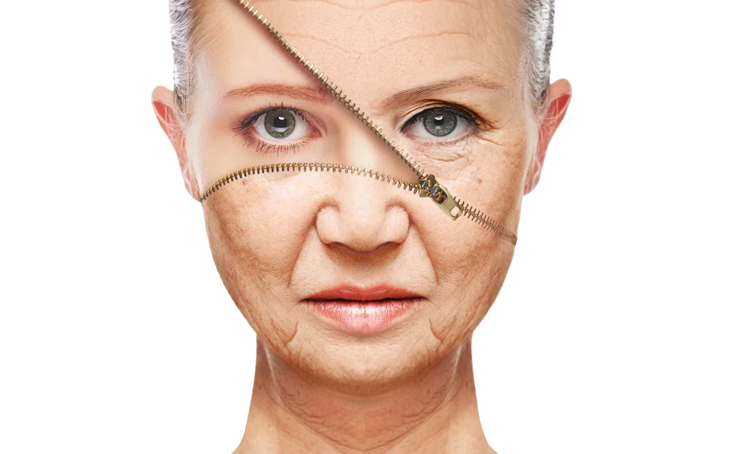 Facelifting